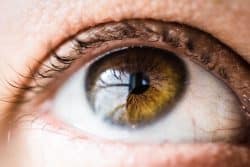 What Are Cataracts?